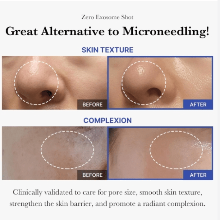 One Day Exosome Shot 7500 - MAKEUPMX Distribuidora